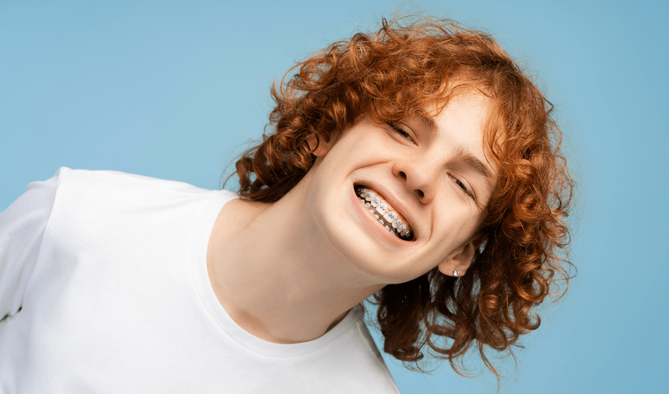 Types of Braces Advanced Orthodontics in Burien, WA